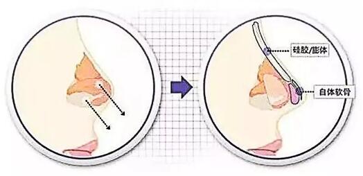 �����ǵ�Ǽⱻ���յ�����ô���