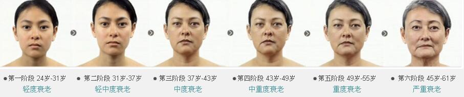 CLS��ϸ����˥�� �ӻ�˥�����Ʒ�