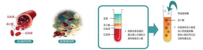 CLS��ϸ����˥�� �ӻ�˥�����Ʒ�