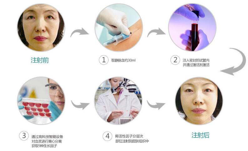 CLS��ϸ����˥�� �ӻ�˥�����Ʒ�