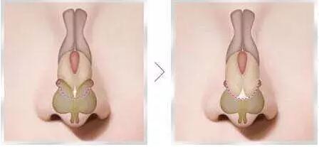 ���й��ǡ��Ǽ���ص����Ż�����