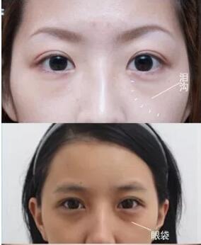 �ṵ����ô�γɵ��Լ���ô�����ṵ