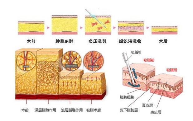 ����Easylipo����֬��  �ݾ�����ô��