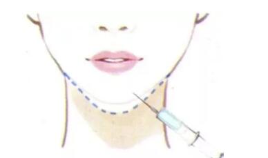 ע��¡�°���߶˼������¡򤼼��