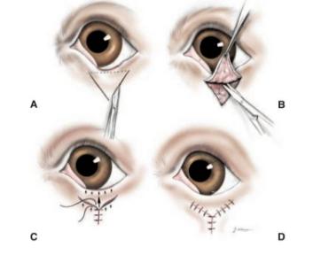 �������ⷭ��רҵ֪ʶ �˽�һ���кô�