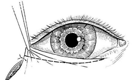 �������ⷭ��רҵ֪ʶ �˽�һ���кô�