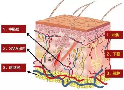 �����᣺ȫЧ��˥�ڿƼ���һ��ɨ���ɡ�������