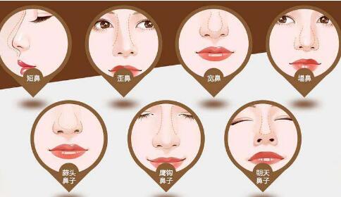 ��¡��or�ۺ�¡�ǡ�90%���˶�ѡ����