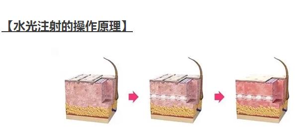 ����ǰϦ������һ�벣����ע�䡰�����������