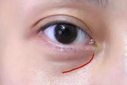 ȥ�۴���ȥ�ṵ�����õķ���