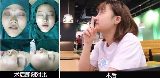 �����������ͣ�Ϊʲô�����ַǳ���