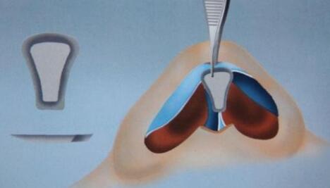 �������ǵ�Ǽ⵽������ô����