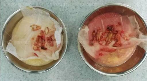 �����οڱ������ݺ�Ͽ����̷�¶�Ժ���İ�����ȡ������