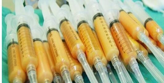 ����֬���沿���Ч���ܱ��ֶ��