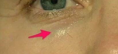 �̵�10�ֲ������������Ĳ���֢���䴦����ʽ