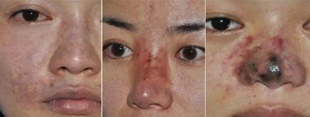 �̵�10�ֲ������������Ĳ���֢���䴦����ʽ