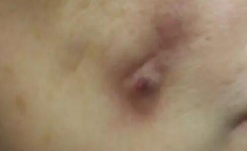 �̵�10�ֲ������������Ĳ���֢���䴦����ʽ