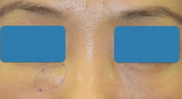 �̵�10�ֲ������������Ĳ���֢���䴦����ʽ