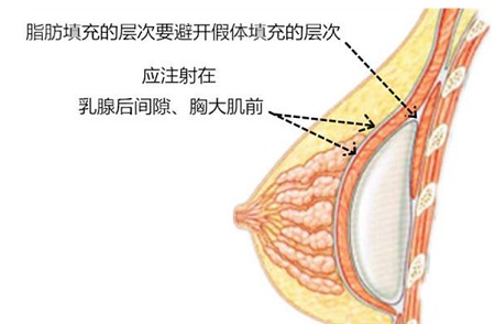 ����֬��¡�غͼ���¡�ؿ���һ������