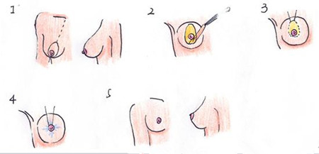 ˫�����鷿������ô�� ����Щ�ŵ��ȱ��