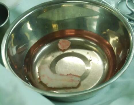 �����������������ź����θ�ɽԺ���������Ǳ��ۺ�����