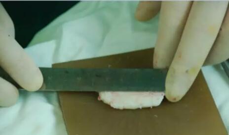 �����������������ź����θ�ɽԺ���������Ǳ��ۺ�����