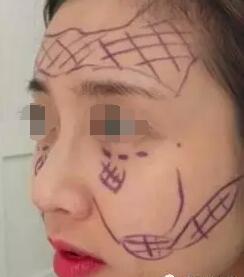 ����֬��ƻ���������е�����