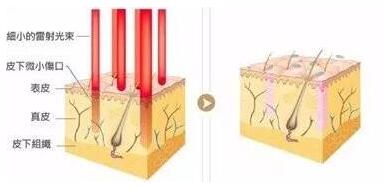 ���˰̺ۼ����òŻָ� ��������Щע������