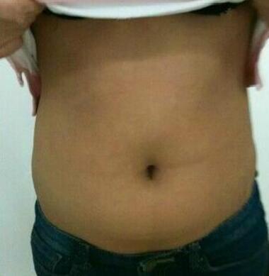 ��������֬�����������������С����