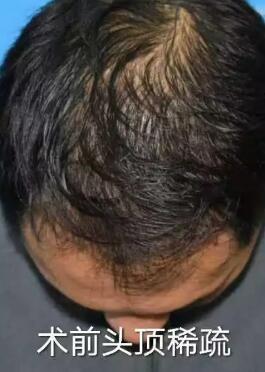 ֲ������ʮ����ͷ��������Ϸ��̨