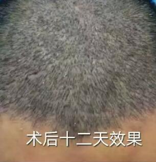 ֲ������ʮ����ͷ��������Ϸ��̨