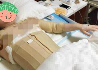 �ֱ���֬���������γ����������ֱ�