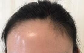 ��������ֲ����������30�귢����ƫ��