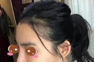 ��������ֲ����������30�귢����ƫ��