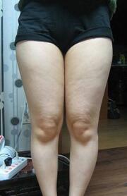 ������֬������3���º�ӵ�п�����