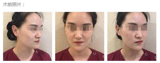 ��������֬������� ������������