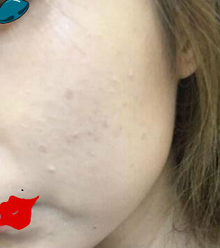 ע�䲣����ע��7���Ƥ��ˮˮ����