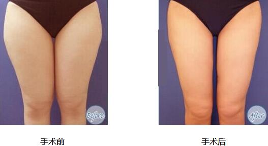 ���·ǳ������ҽ���ݴ��ȷ�����3��