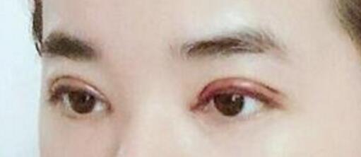 ˫��Ƥ����50�����ȥ�ˣ���ֵ����N������