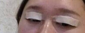 ������ҽ����������˫��Ƥ+�������۽�����4����