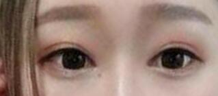 ������ҽ����������˫��Ƥ+�������۽�����4����