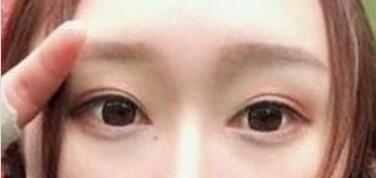 ������ҽ����������˫��Ƥ+�������۽�����4����