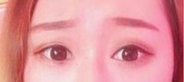 ������ҽ����������˫��Ƥ+�������۽�����4����