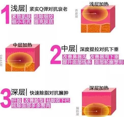 �������壺����̫���ƽ�΢�롢���꼪��������Ƶ���������к�����