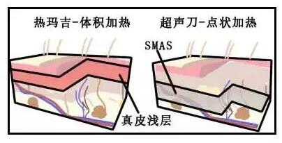 �������壺����̫���ƽ�΢�롢���꼪��������Ƶ���������к�����