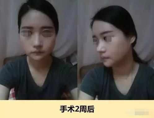 vline���� �����ӵ�й�����������