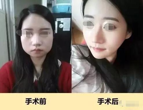 vline���� �����ӵ�й�����������