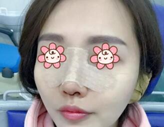 ����ǽ����Ļָ�ʱ�䲻�ܸ���ȷ����ʱ��