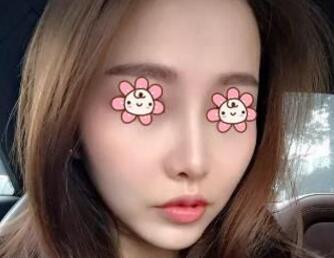 ����ǽ����Ļָ�ʱ�䲻�ܸ���ȷ����ʱ��