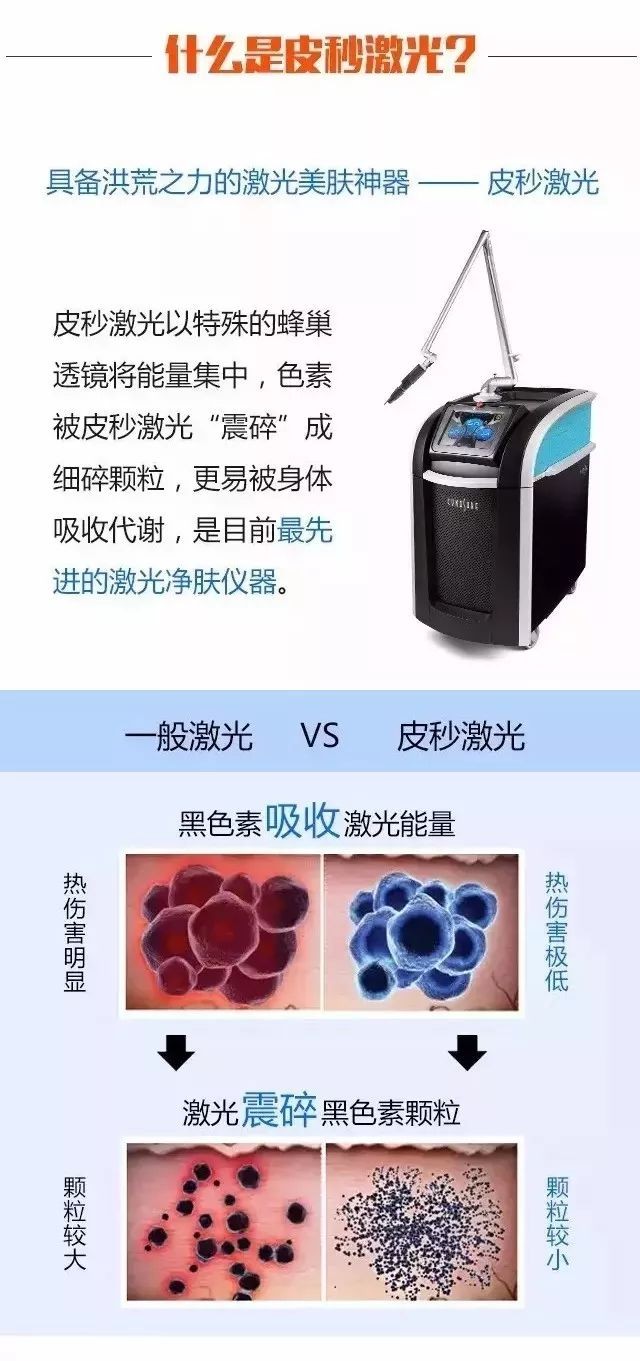 8��16�ճ�����֮��Ƥ�뼤������ר������ڹ���������� 